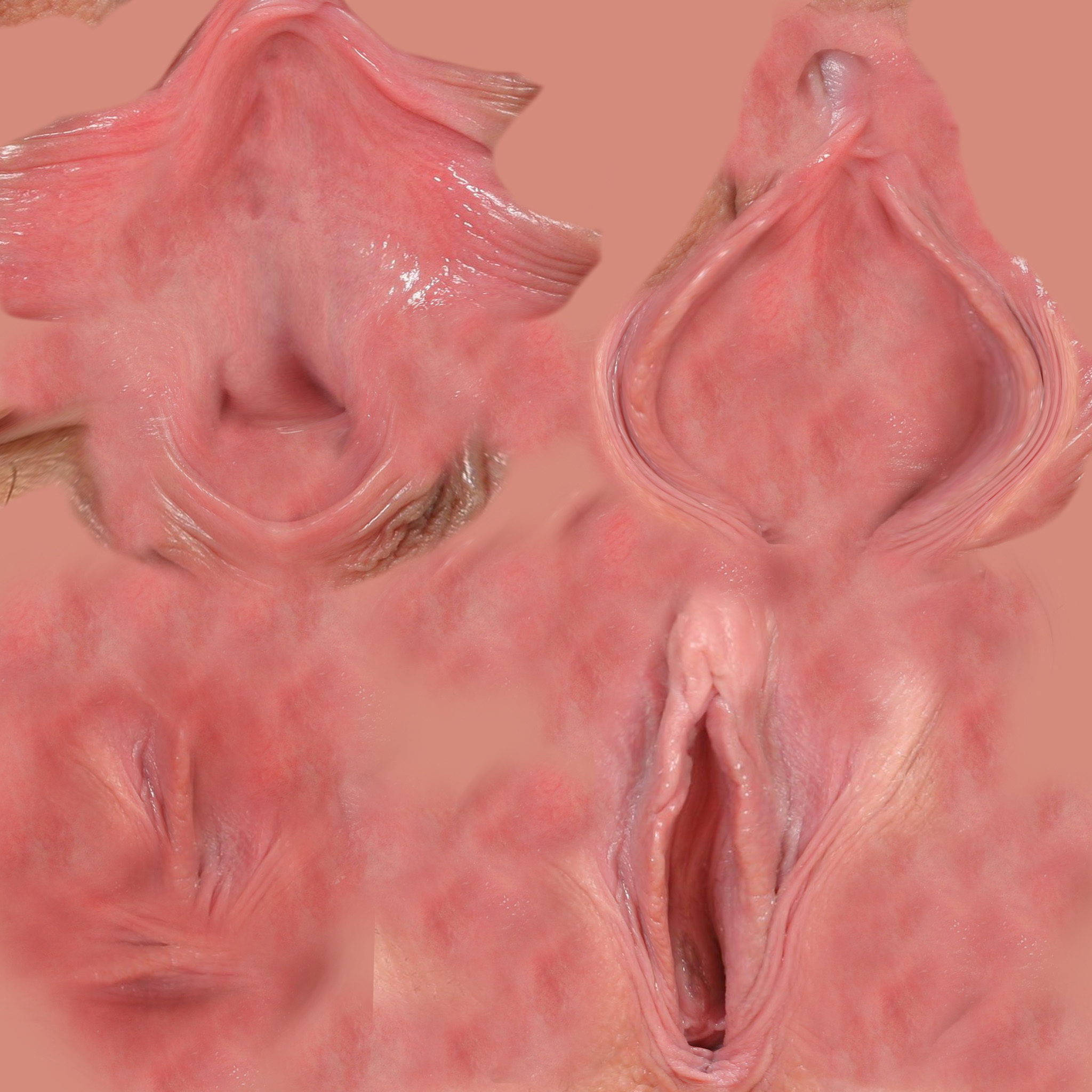 Noed vagina femel