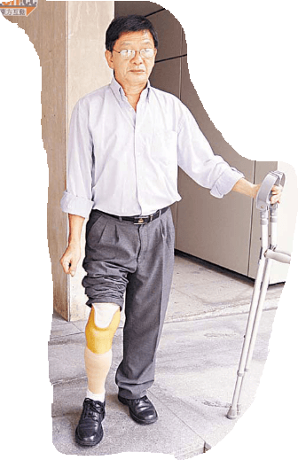 法庭:不獲發傷津 截肢漢求覆核